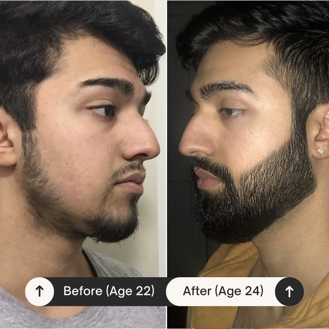 Bachelor's Signature® Beard Growth Kit