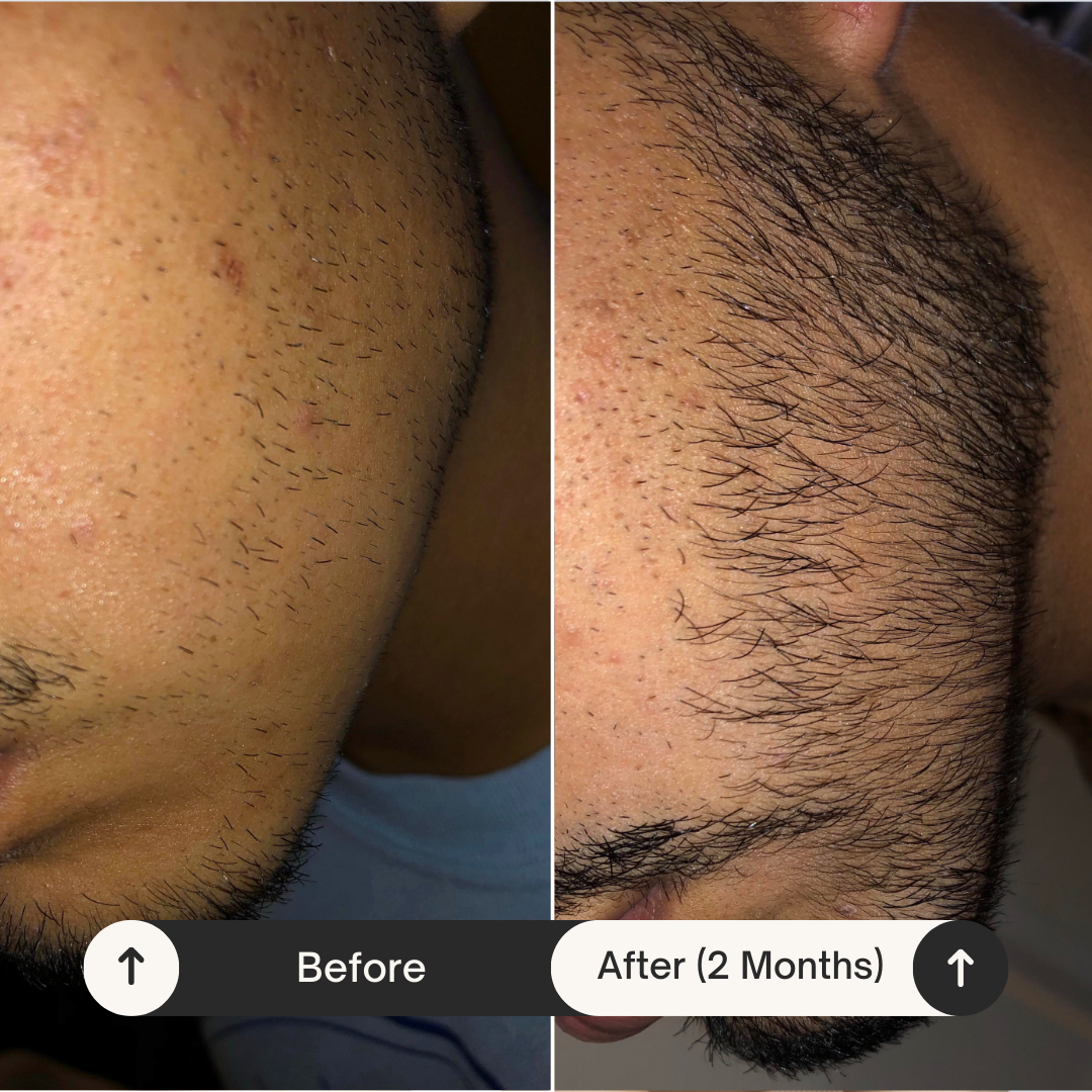 Bachelor's Signature® Beard Growth Kit